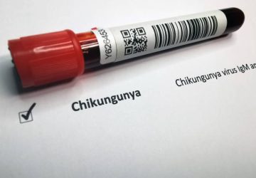Kasus Suspek Chikungunya 2025 Melonjak, Kemenkes Waspada